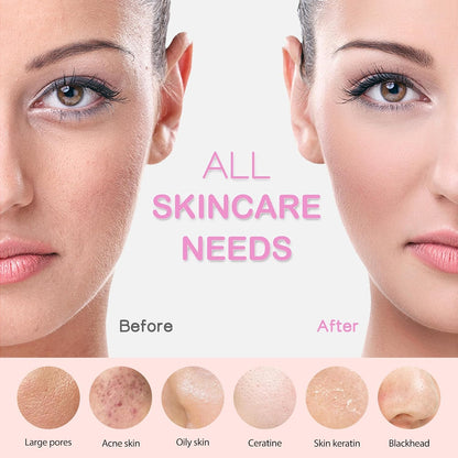 Facial Cleansing Brush, Rechargeable Silicone Face Scrubber with Heat Massage End, Vibrating Exfoliator Scrubber for Deep Cleaning, Waterproof Face Brush for Women and Men (Pink)